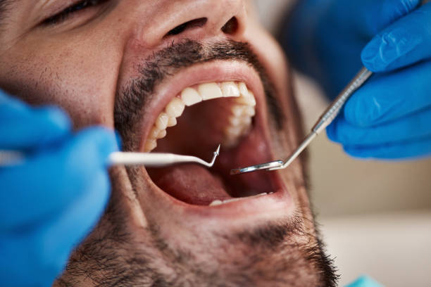 Best Urgent Care for Lost Fillings or Crowns in Cologne, NJ
